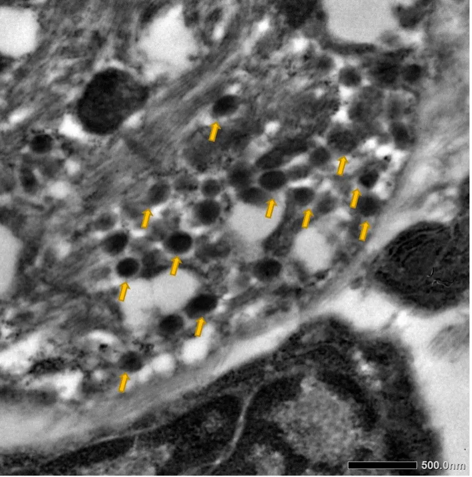 Microscope image of high electron  density vesicles typical of catecholamine-containing  chromaffin cells found in cardiomyocytes