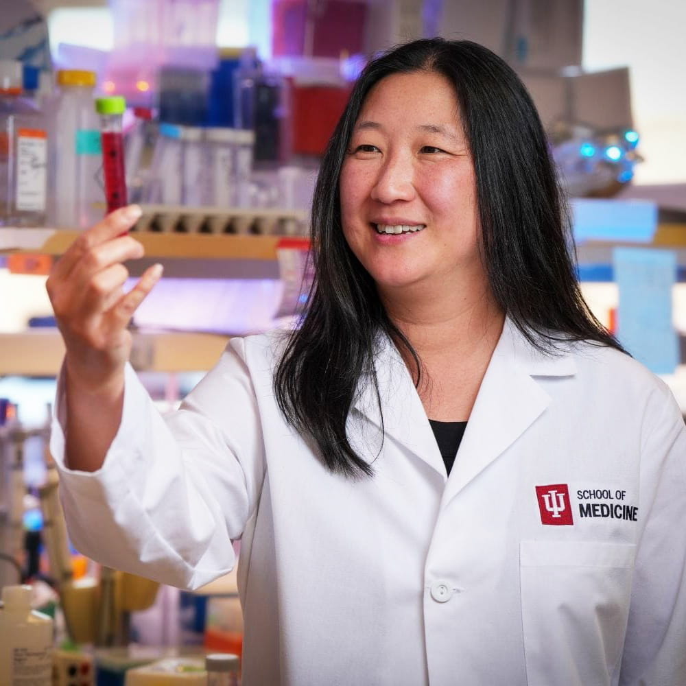 Elizabeth Yeh holds a test tube filled with a red solution up to eye level. She is wearing a white lab coat with the IU School of Medicine logo on the chest