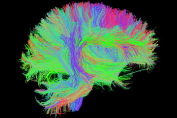 multicolored neural networks make the shape of brain in an imaging scan