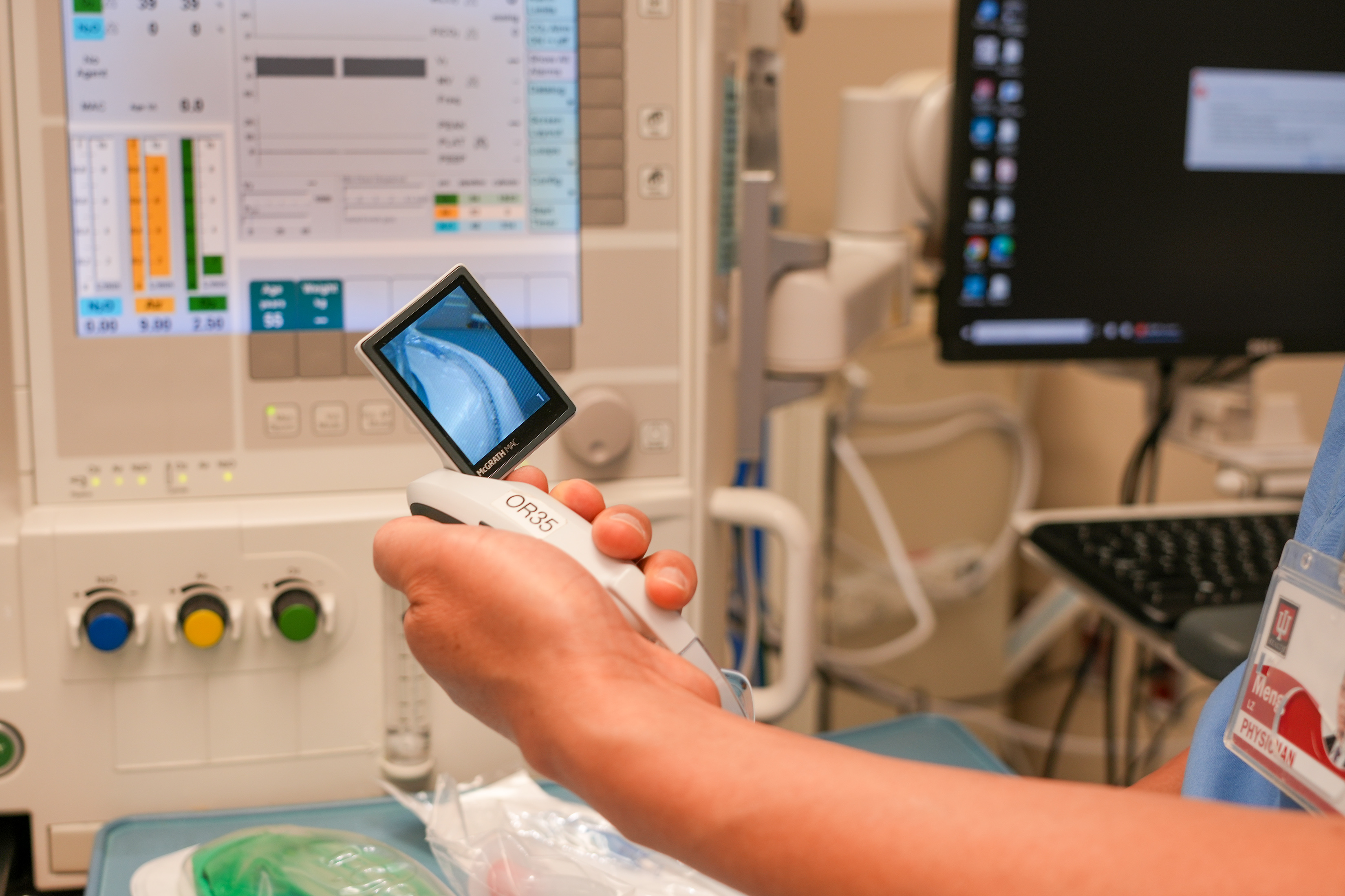 Close-up of a clinician’s hand holding a handheld medical scope displaying an internal airway image, with monitoring equipment in the background.