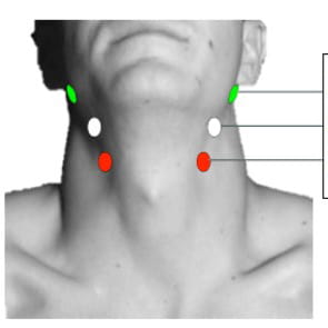 Photo of cutaneous recording of the vagus nerve