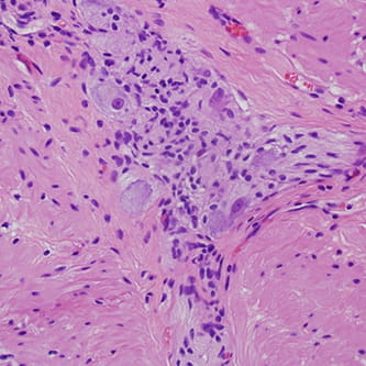 Photo of GI Neuromuscular Pathology