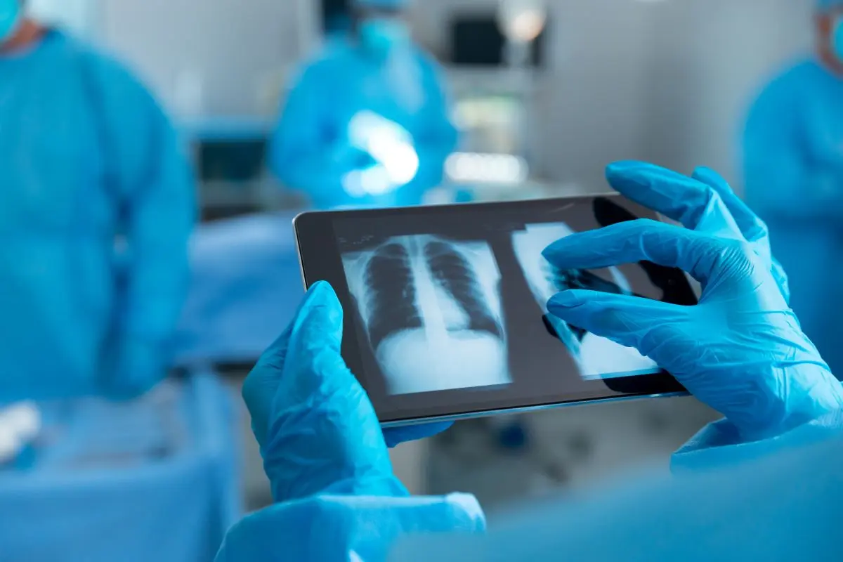 Doctor looking at lung xray on ipad