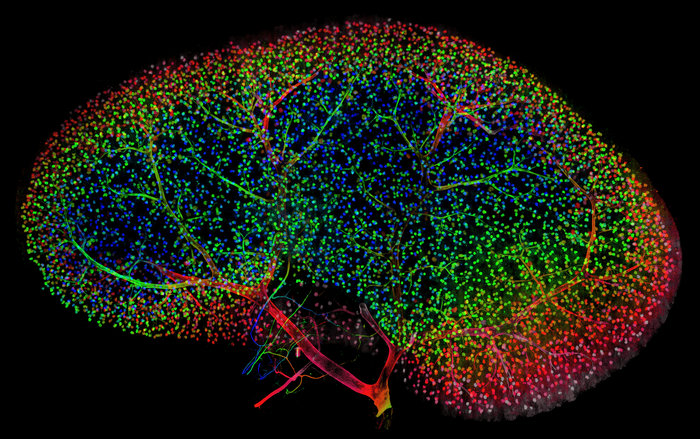 imaging of a kidney in rainbow colors