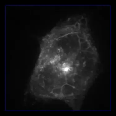living cell imaging