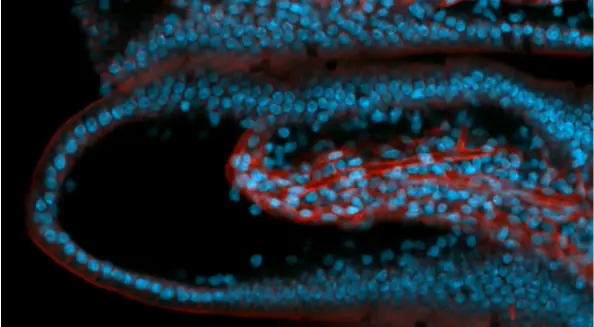 intestine imaging