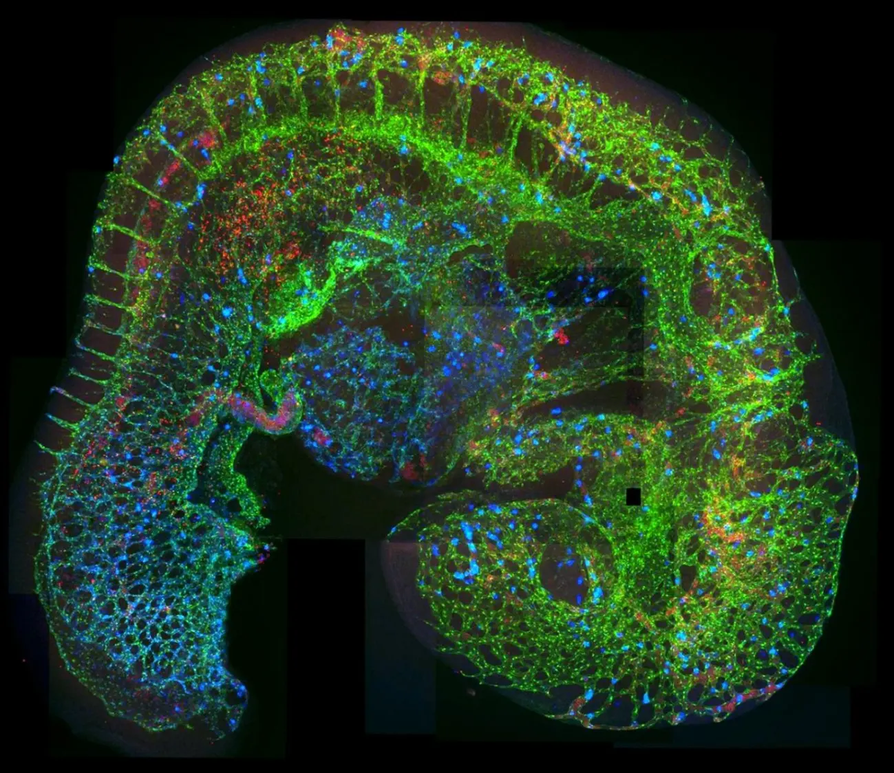 embryo