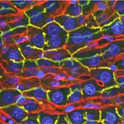 confocal microscopy