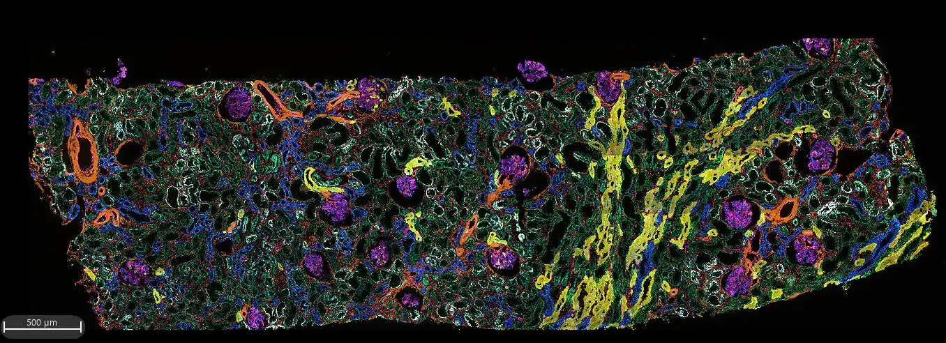 Codex Staining CODEX Microscopy | Indiana Center for Biological Microscopy | IU School ...