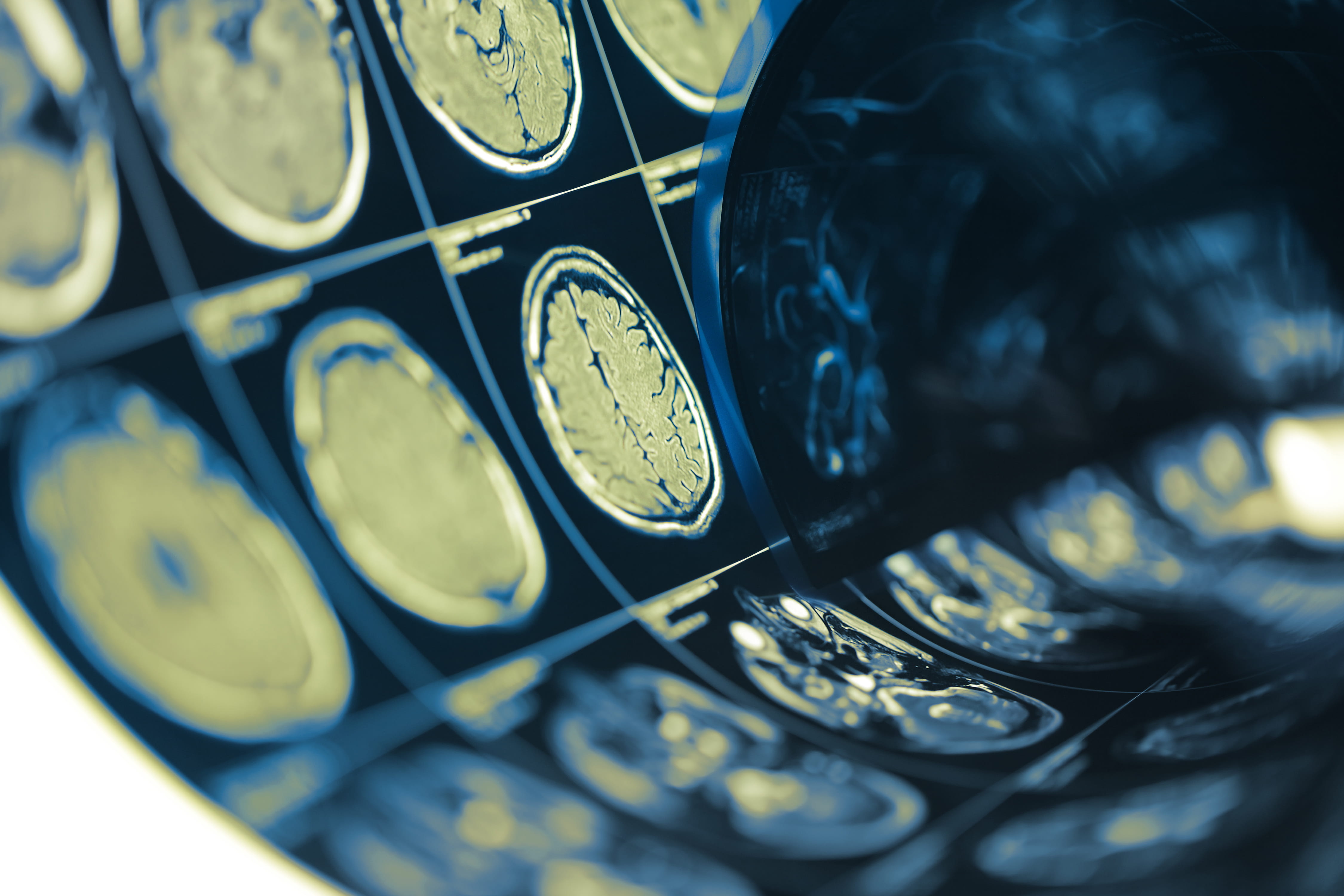 Human brain scan testing film folded in a roll