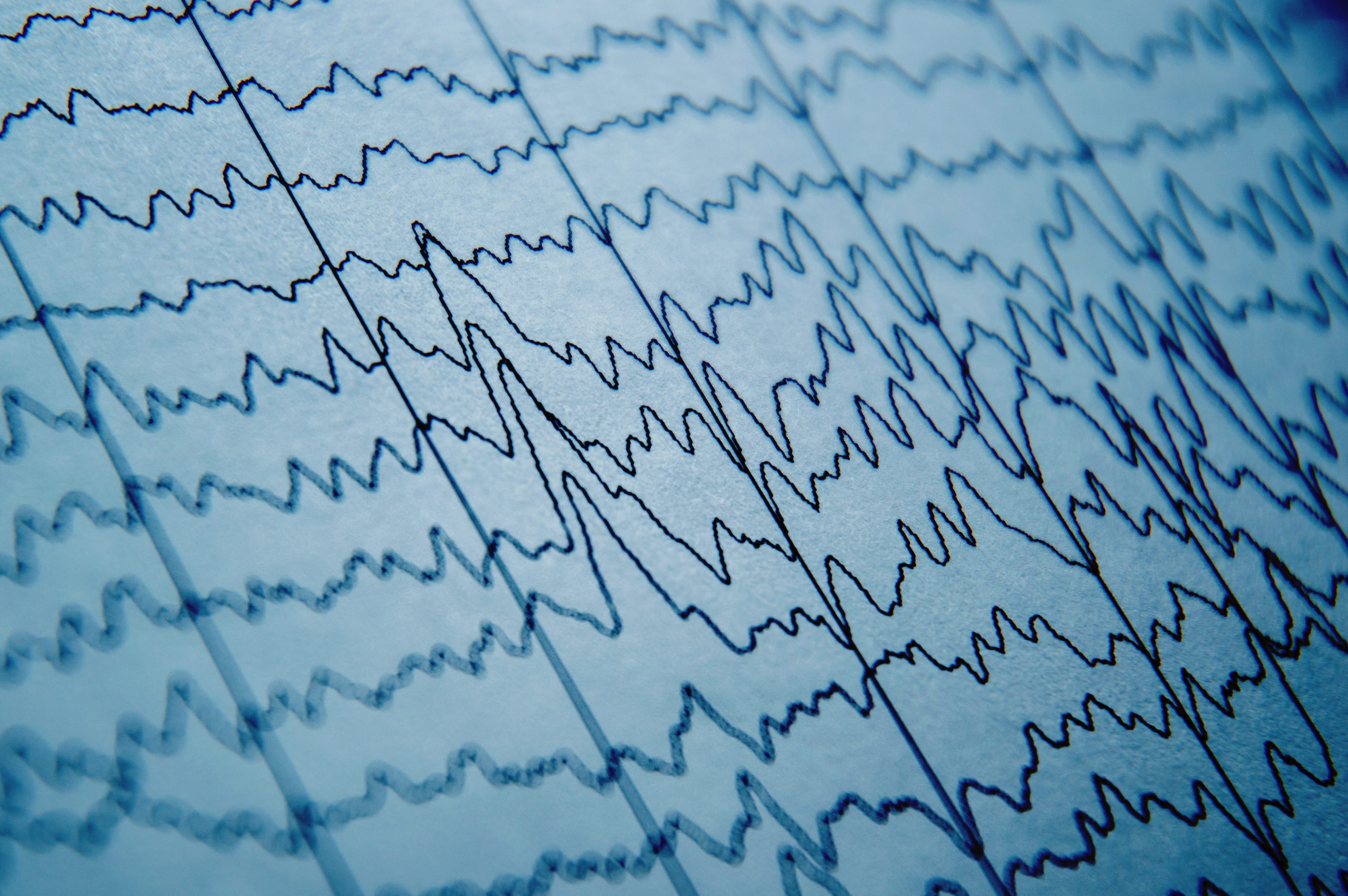 an EEG readout