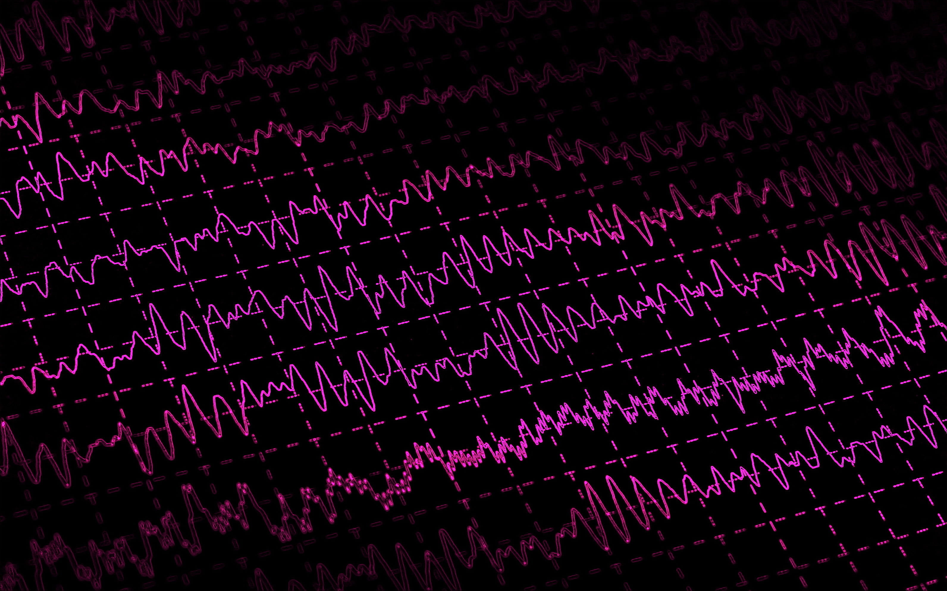 an EEG readout