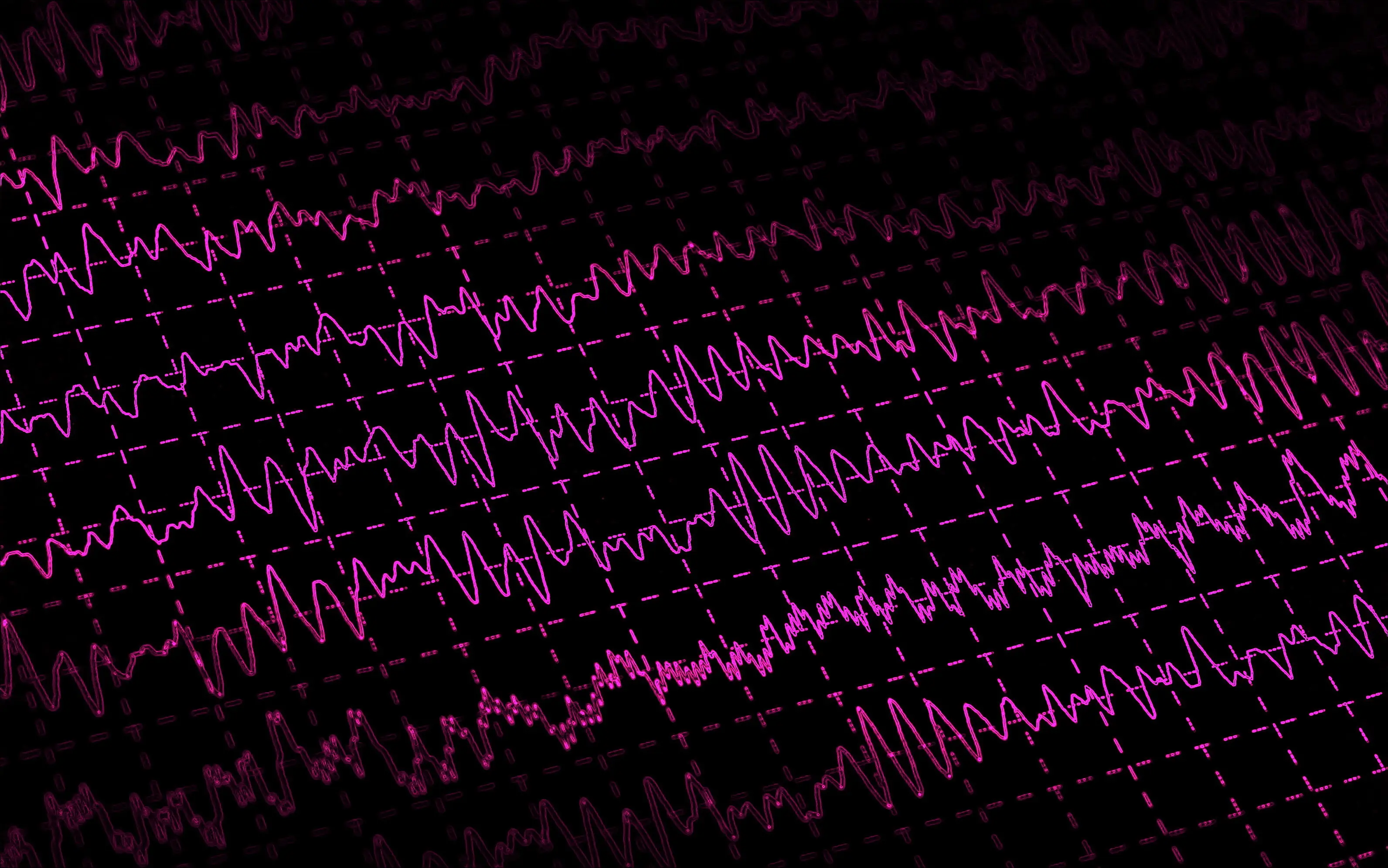 an EEG readout