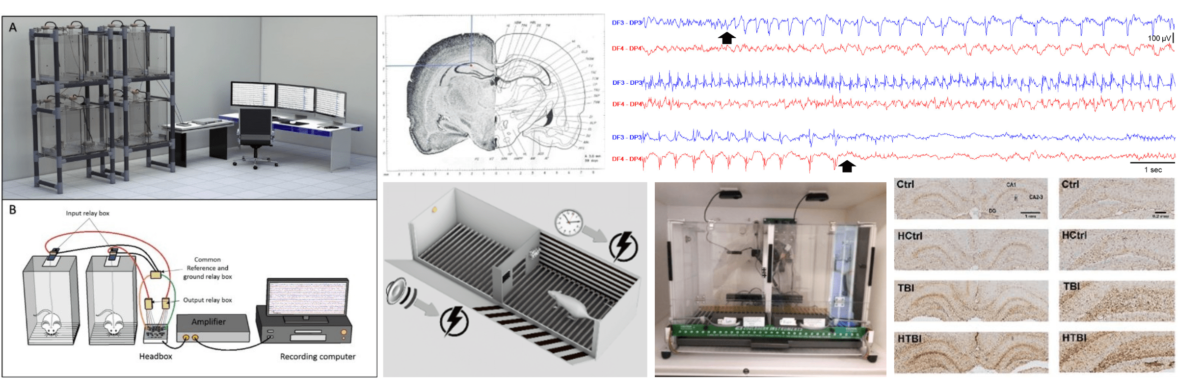 rodent epilepsy monitoring unit and results