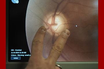 A scan of a patient’s eye is displayed on a computer screen.