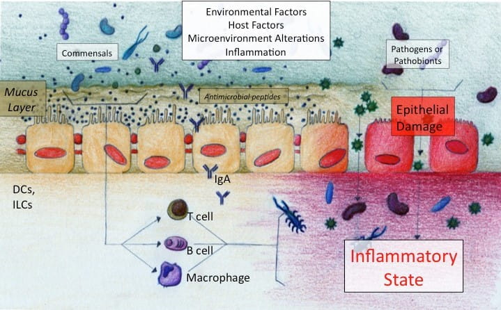 Environmental and Host factors. Microenvironment Alterations and Inflamation.