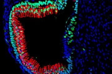 Research photo of inner ear hair cells