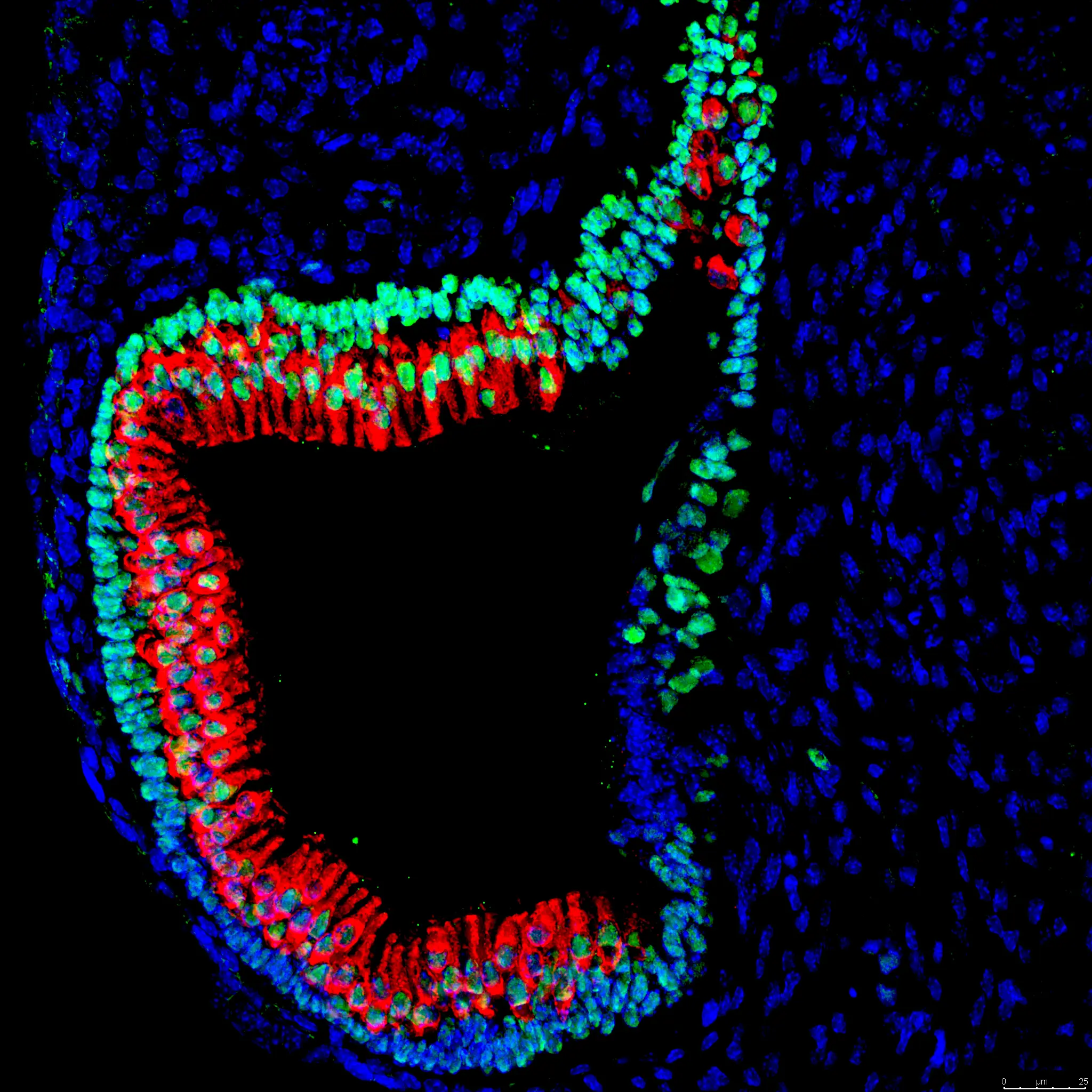 A microscopic scan shows many small cells in blue, green and red