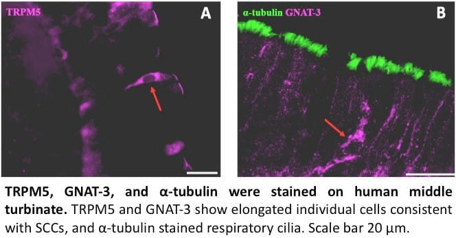 Two images. TRPM5 and GNAT-3 showing elongated individual cells consistent with SCCs.