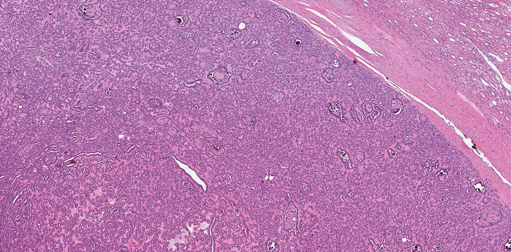 a pathology slide stained in purple