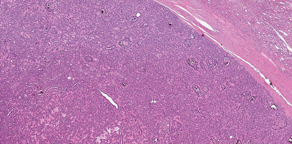 a pathology slide stained in purple