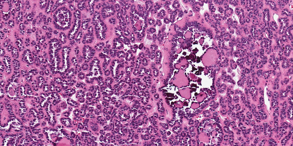 a pathology slide stained in purple