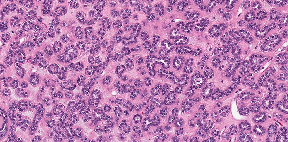 a pathology slide stained in purple