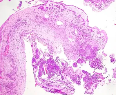 Case image 1