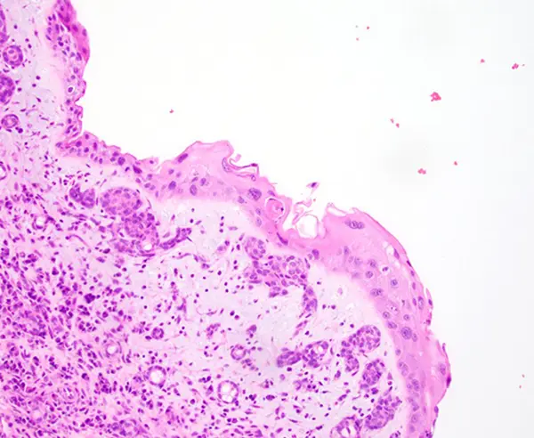 Case image 2