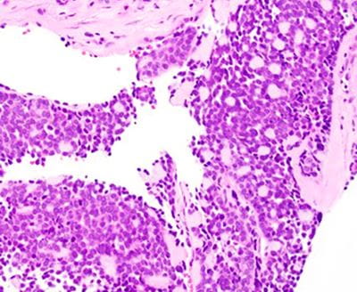 Case image 3