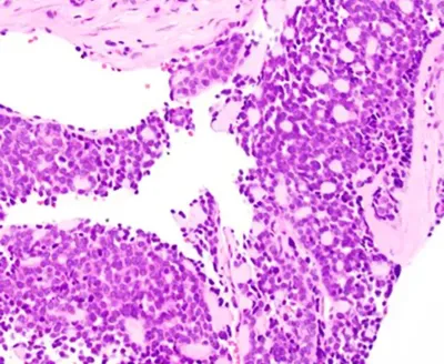 Case image 3