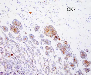 Case image 6