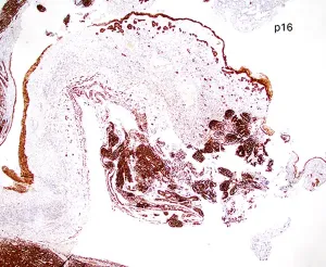 Case image 7