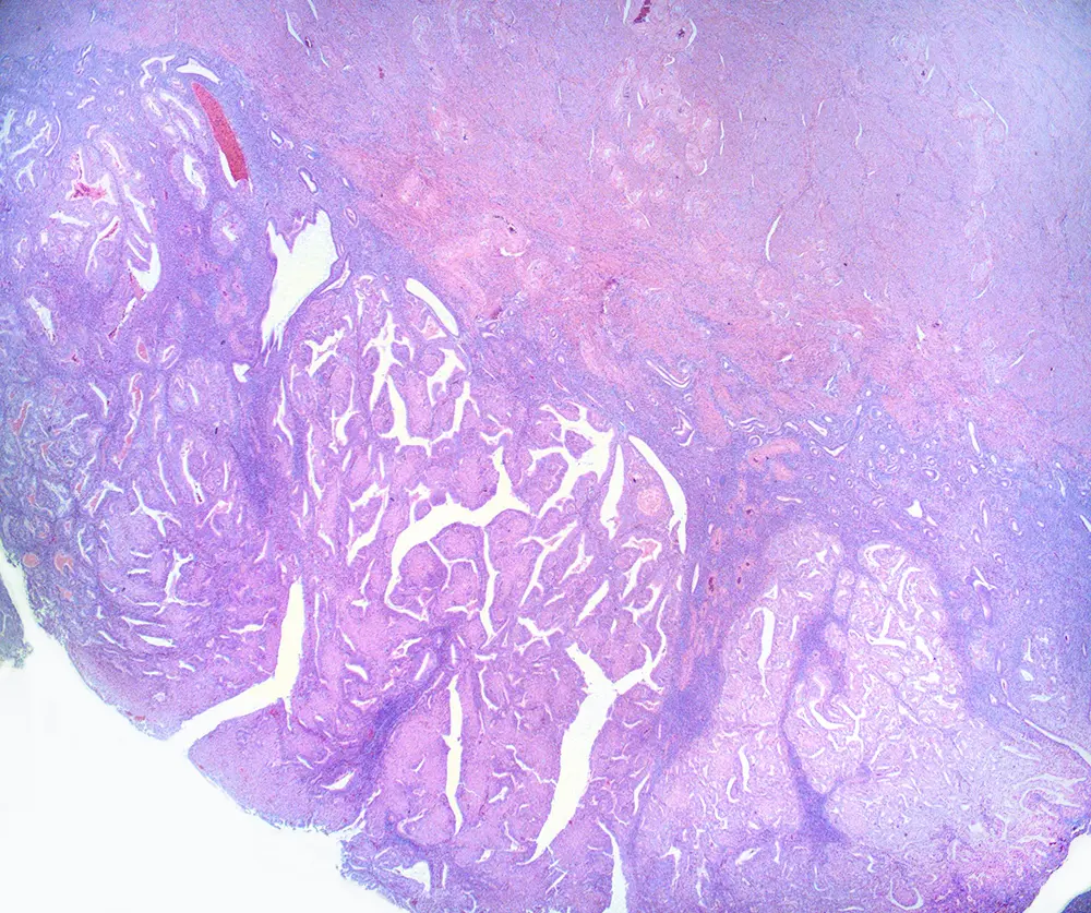 Case of the Month, Figure 6