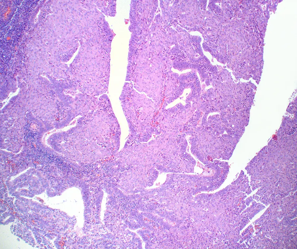 Case of the Month, Figure 7