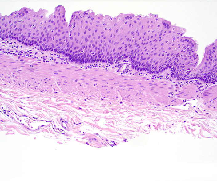 cyst lining histology slide