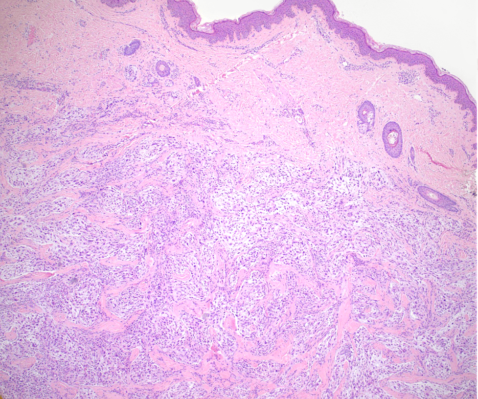 Case of the Month, October 2025, Figure 1. Microscopic image