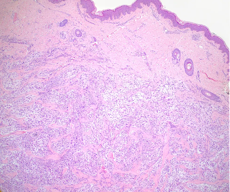 Case of the Month, October 2025, Figure 1. Microscopic image