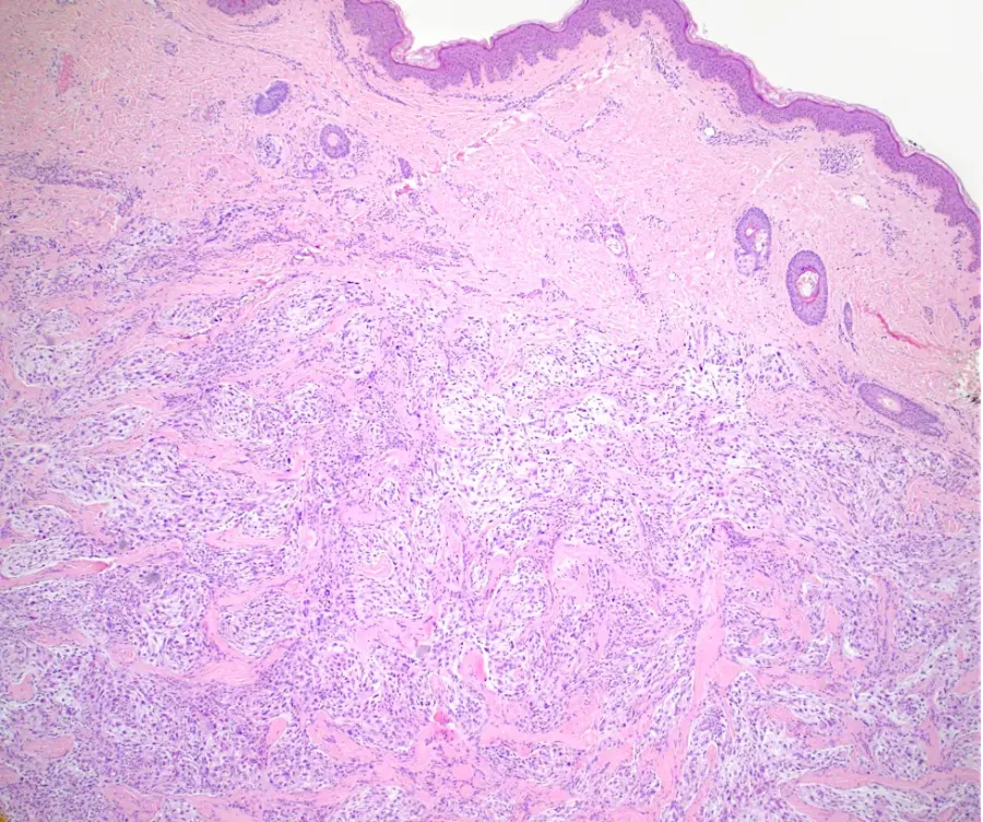 Case of the Month, October 2025, Figure 1. Microscopic image