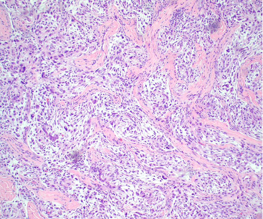 Case of the Month, October 2025, Figure 2. Microscopic image