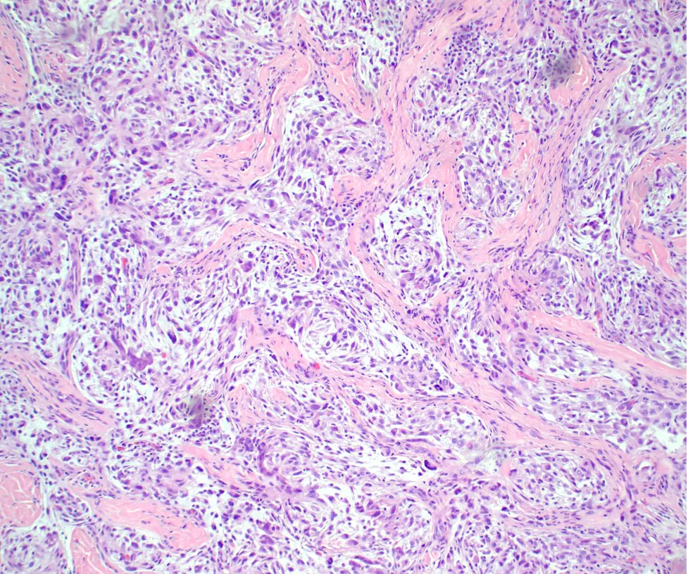Case of the Month, October 2025, Figure 2. Microscopic image