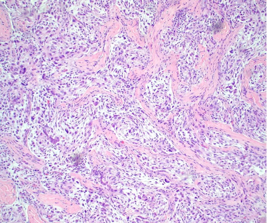 Case of the Month, October 2025, Figure 2. Microscopic image