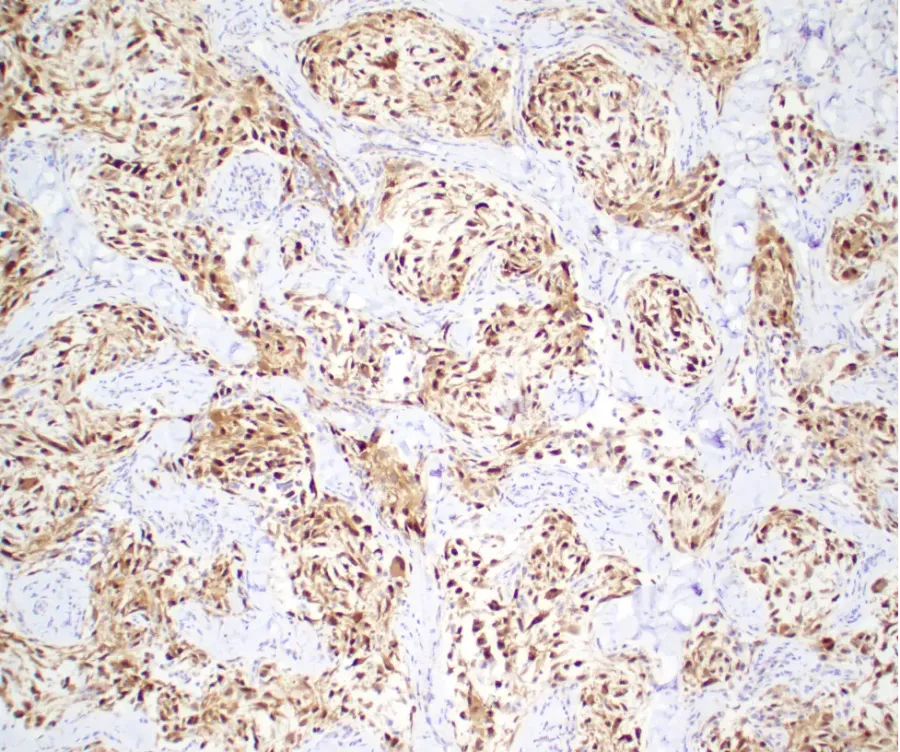 Case of the Month, October 2025, Figure 3. Microscopic image