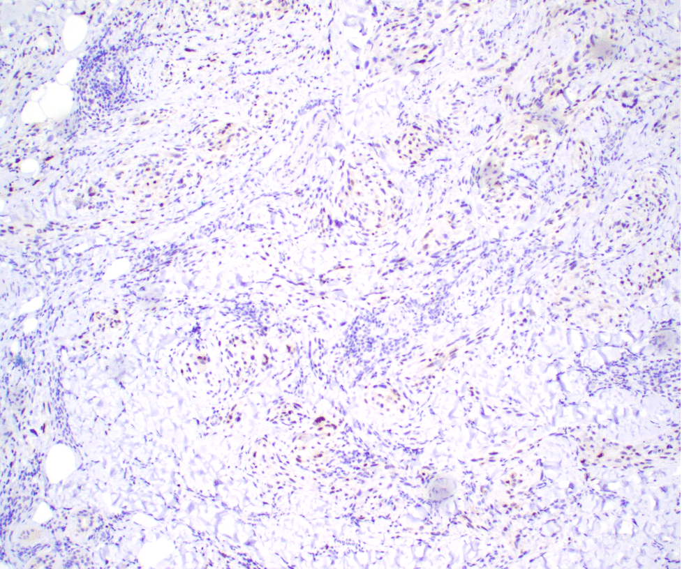 Case of the Month, October 2025, Figure 4. Microscopic image