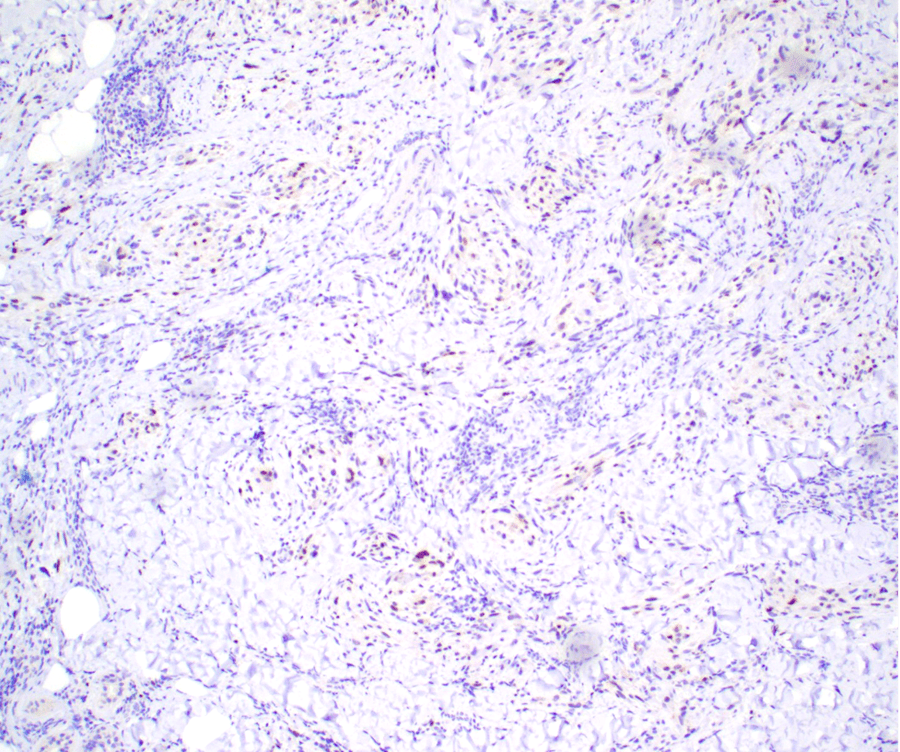 Case of the Month, October 2025, Figure 4. Microscopic image