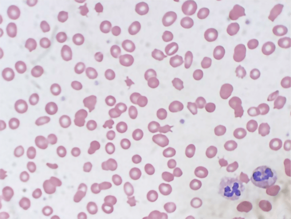 Case of the month 6, photo of cells