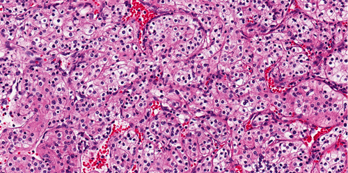 Photo of cells