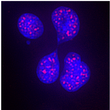 imaging of cell in blue and pink