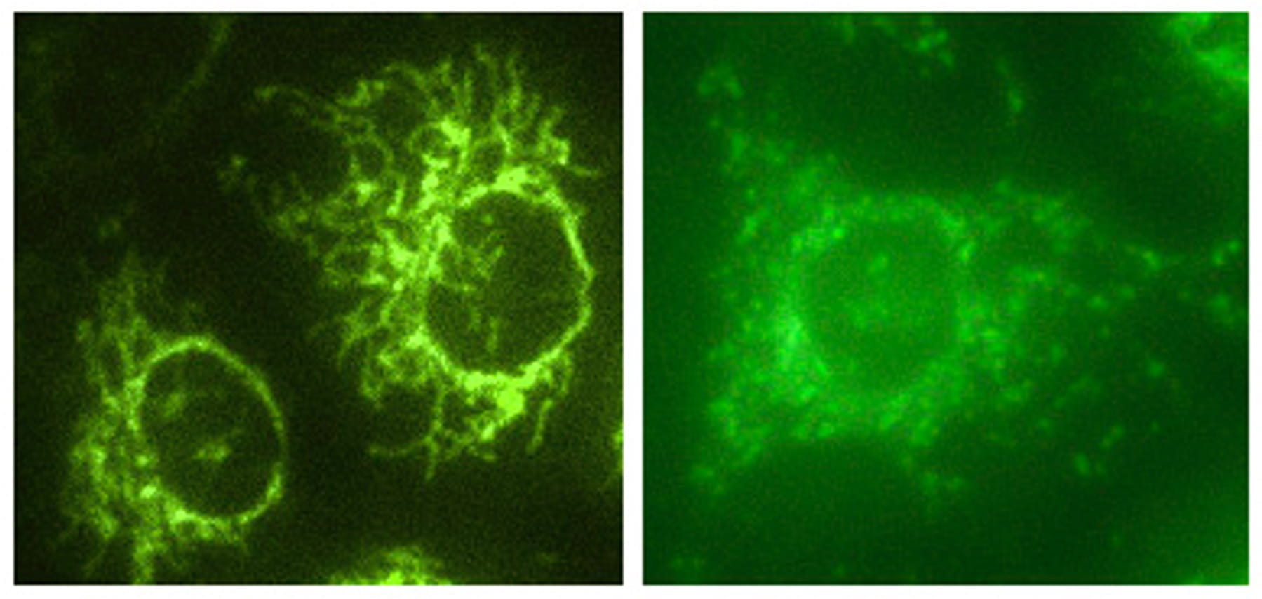 Two panels showing fluorescent microscopy images of cells with bright green staining, highlighting cellular structures and patterns, possibly related to mitochondrial or protein distribution