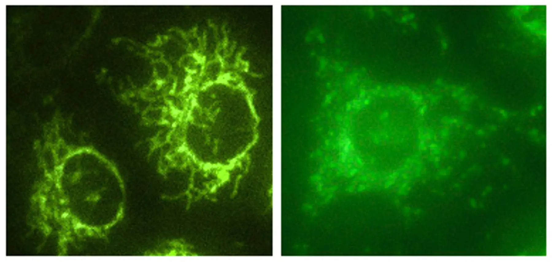 Two panels showing fluorescent microscopy images of cells with bright green staining, highlighting cellular structures and patterns, possibly related to mitochondrial or protein distribution